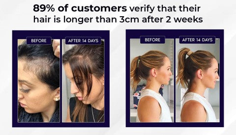 Spray naturale per la ricrescita dei capelli HZA™