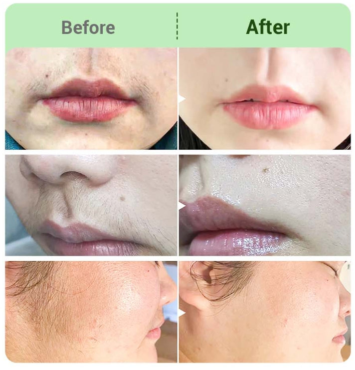 ⚡ Ardú Céime an Lae Deiridh - Ceannaigh 1 Faigh 2 Saor in Aisce⚡Trealamh Uachtair um Bhaint Gruaige do Mhná💛💛