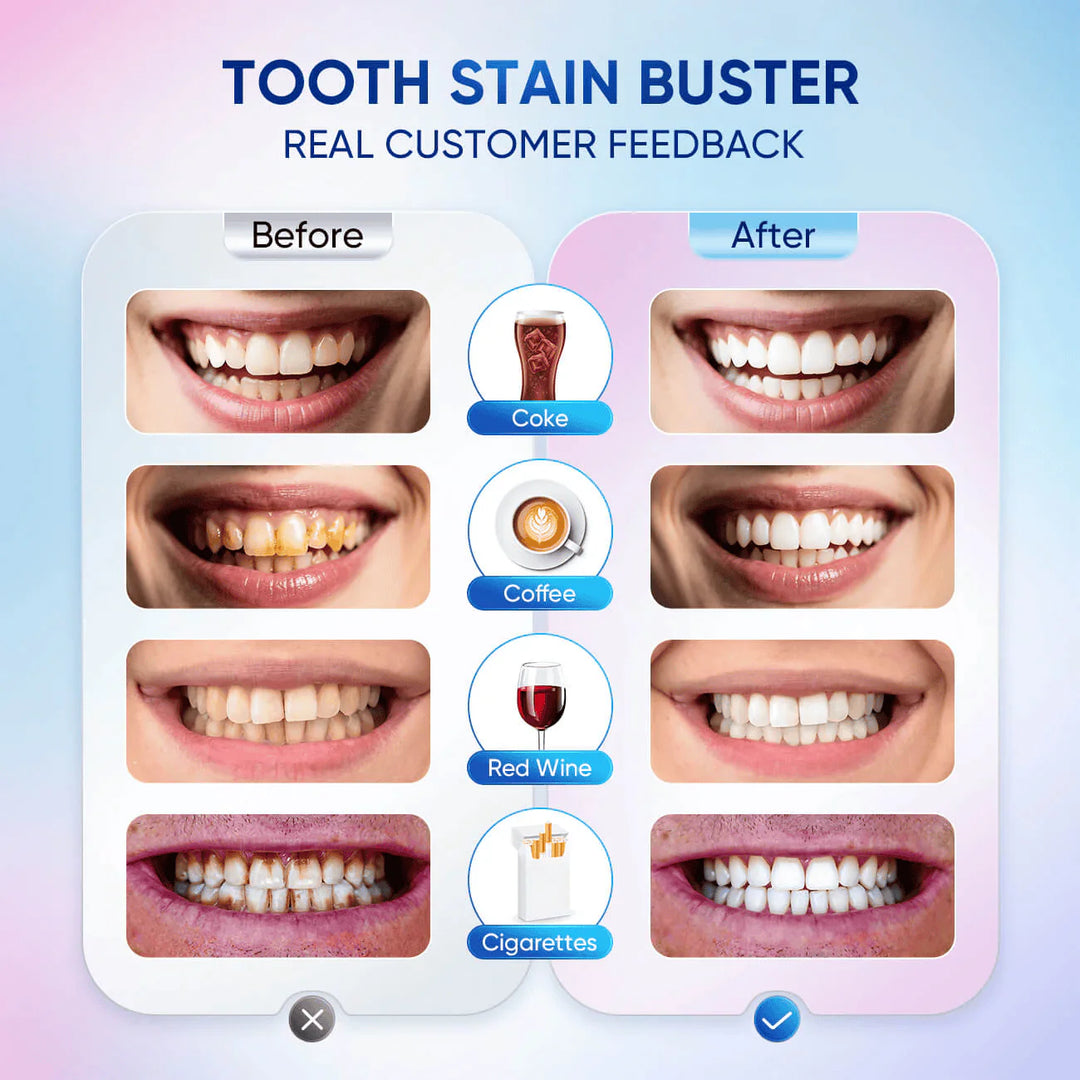 【Max】BodyAccel 【Triple Whitening】Niacinamide Whitening Toothpaste