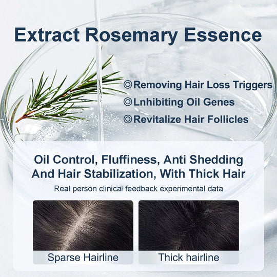 שמפו רוזמרין Tgideas