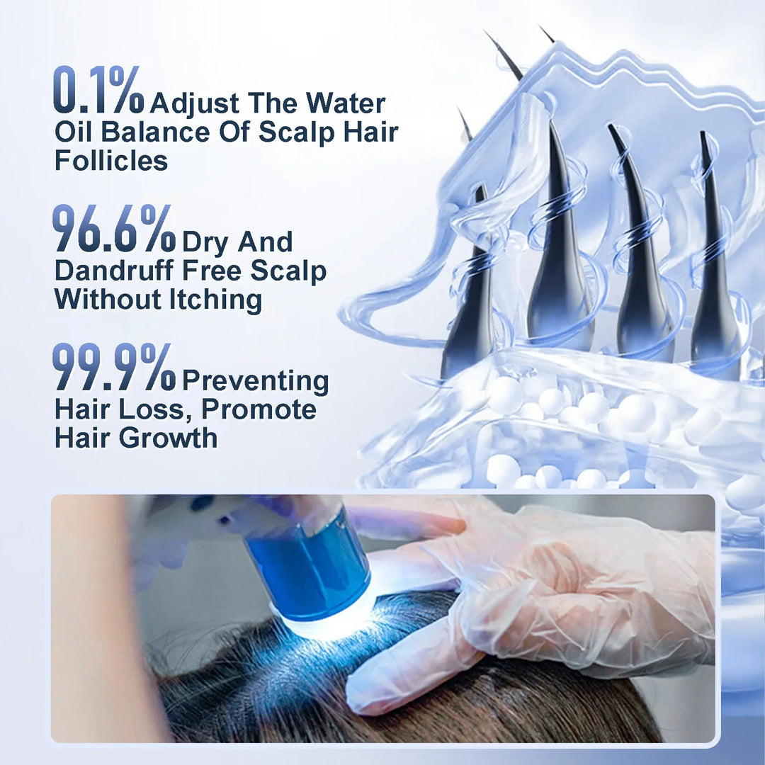 שמפו רוזמרין Tgideas