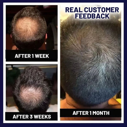 Spray naturale per la ricrescita dei capelli HZA™