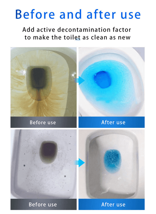 🔥Last Day Surprise Price⏰SINK & DRAIN CLEANER
