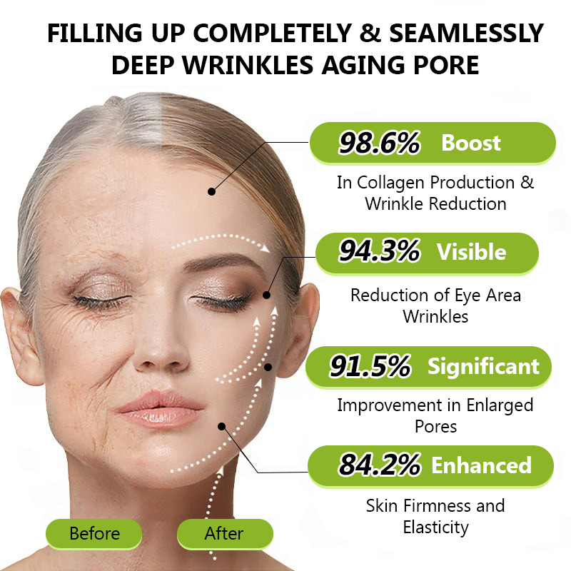 𝑶𝒇𝒇𝒊𝒄𝒊𝒂𝒍 𝑺𝒕𝒐𝒓𝒆👍| Faigh craiceann óg ar ais anois 💫STDEI® BOTOX & Uachtar Teannadh Ardaithe Roic VITA A RETINOL SHOT