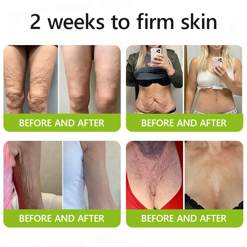 𝑶𝒇𝒇𝒊𝒄𝒊𝒂𝒍 𝑺𝒕𝒐𝒓𝒆👍| Faigh craiceann óg ar ais anois 💫STDEI® BOTOX & Uachtar Teannadh Ardaithe Roic VITA A RETINOL SHOT