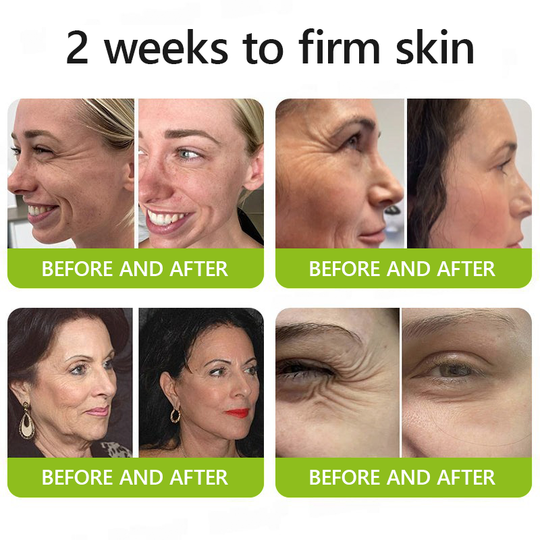 𝑶𝒇𝒇𝒊𝒄𝒊𝒂𝒍 𝑺𝒕𝒐𝒓𝒆👍| Faigh craiceann óg ar ais anois 💫STDEI® BOTOX & Uachtar Teannadh Ardaithe Roic VITA A RETINOL SHOT