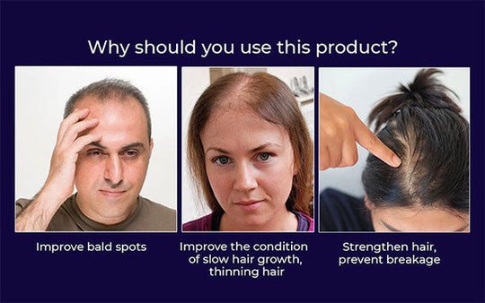 Spray naturale per la ricrescita dei capelli HZA™