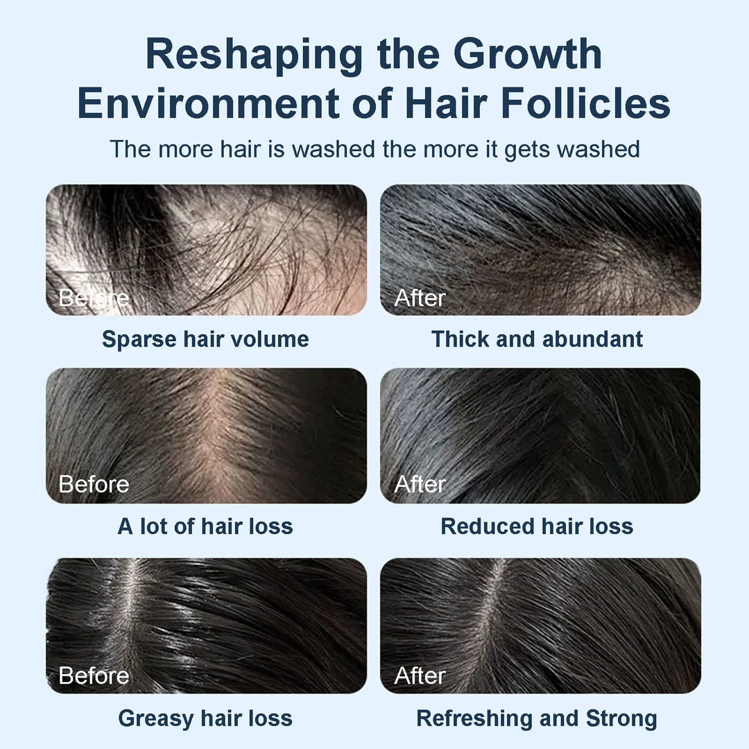 שמפו רוזמרין Tgideas