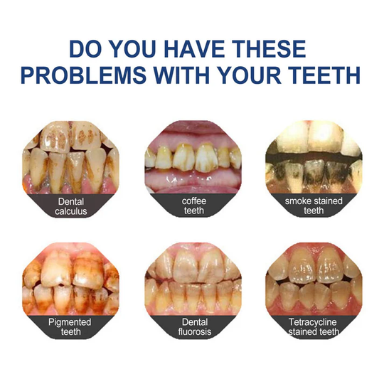 🔥Ends Tonight: Get 40% OFF Before It’s Gone!🎁 YaGoo™ Fluoride-Free Hydroxyapatite Toothpaste – Gentle Whitening & Enamel Strength for Sensitive Teeth