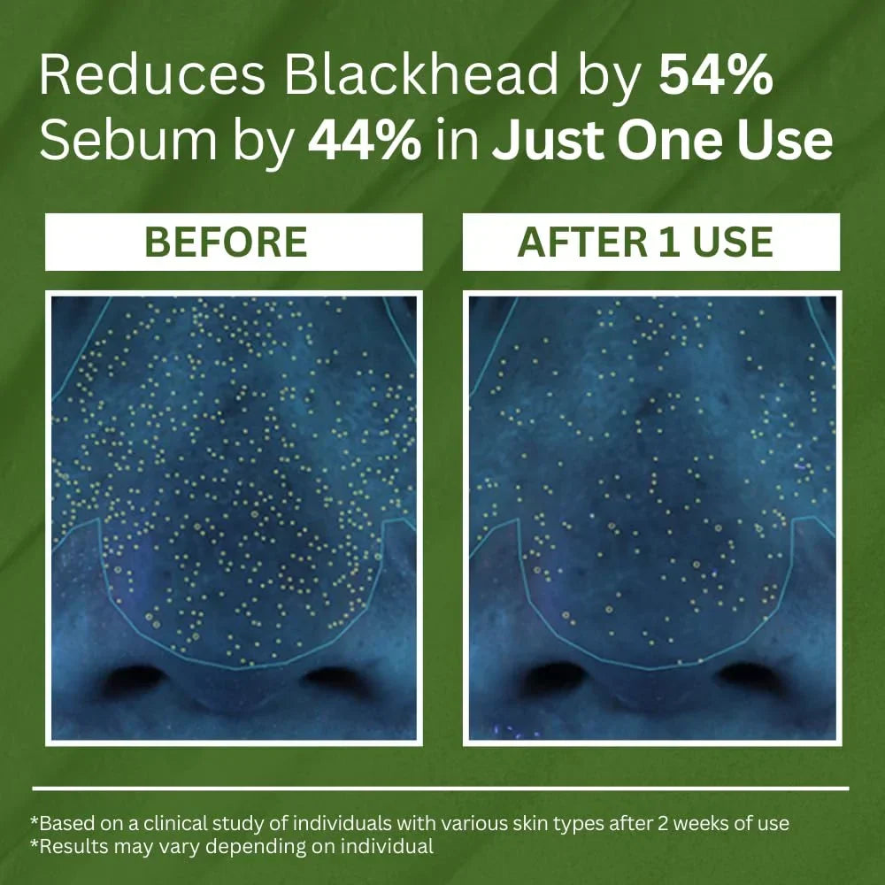 P.CALM Masc Carbónáitithe Basil Naofa: Glantóir Doimhin Póire ag Claochlú Cré go Boilgeoga, Ceann Dubh & Rialú Sebum, Eagraithe Smididh 90g le haghaidh Eispéireas Spa