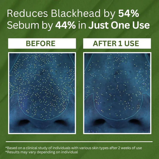 P.CALM Masc Carbónáitithe Basil Naofa: Glantóir Doimhin Póire ag Claochlú Cré go Boilgeoga, Ceann Dubh & Rialú Sebum, Eagraithe Smididh 90g le haghaidh Eispéireas Spa