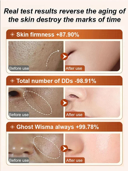 Uppstramande serum mot rynkor