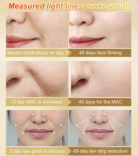 Uppstramande serum mot rynkor