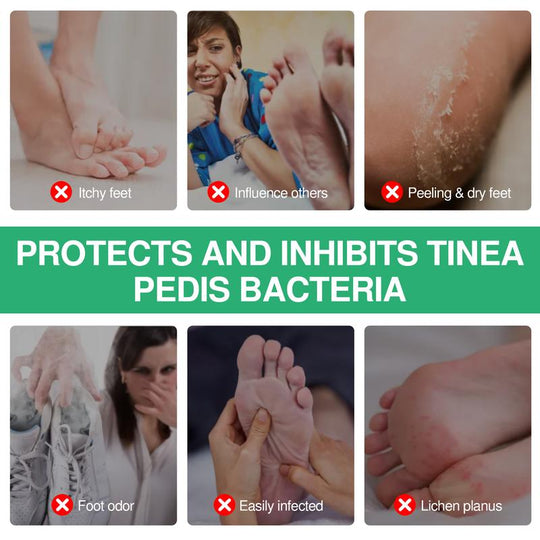 Spraeála Cosa Frithbhaictéarach Luibhe le hOla Crann Tae - Foirmle Fadtéarmach 100ml le haghaidh Boladh Cosa, Cóireáil Cosa Lúthchleasaí & Faoiseamh Tapa ó Thochas