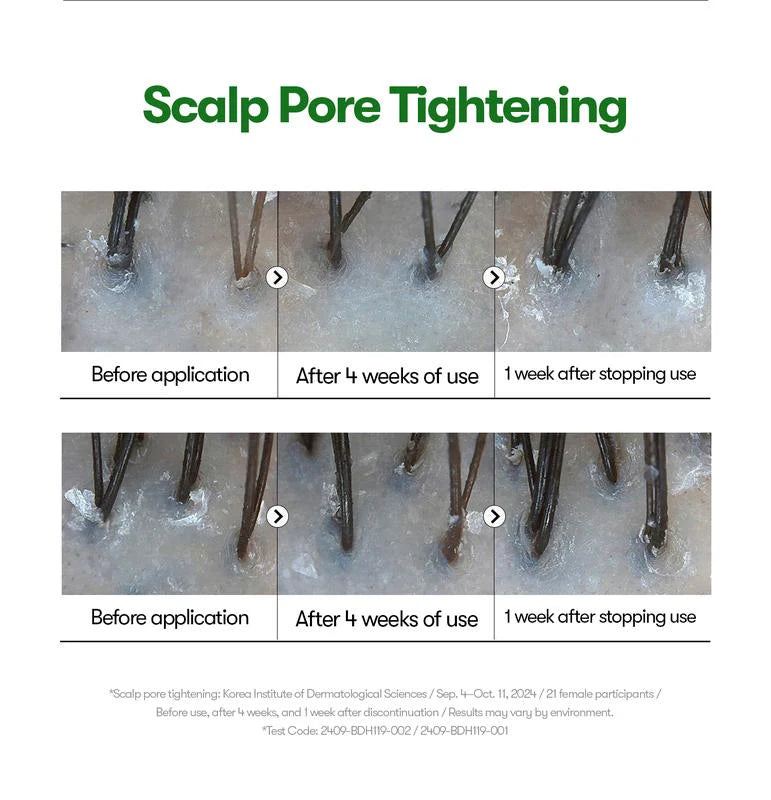 [VT Cosmetics] PDRN Reedle Shot Hair Ampoule 100dl 15ml | Hair Growth Hair loss treatment ampoule serum