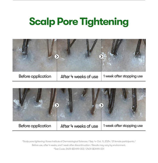 [VT Cosmetics] PDRN Reedle Shot Hair Ampoule 100dl 15ml | Hair Growth Hair loss treatment ampoule serum