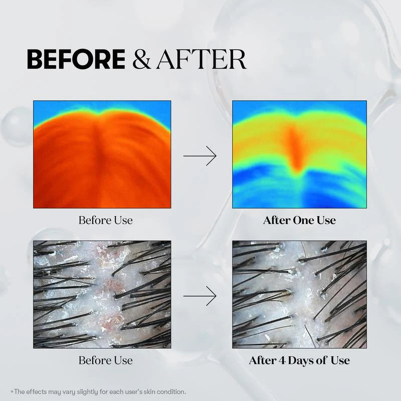 [VT Cosmetics] PDRN Reedle Shot Hair Ampoule 100dl 15ml | Hair Growth Hair loss treatment ampoule serum