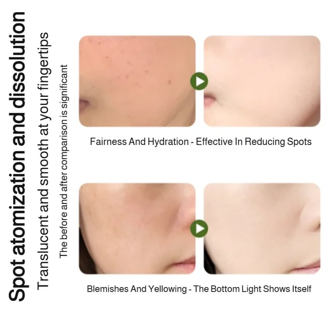 Essenza Spray Idratante Sbiancante