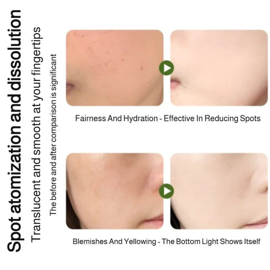 Essenza Spray Idratante Sbiancante