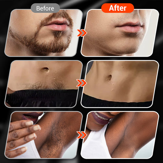 💥Het rea 50% rabatt⏳Ny uppgradering🔥Bärbar mini-rakapparat för män