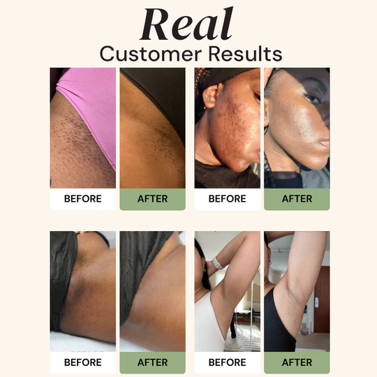 🔥2026 HOT SALE🔥🥰CuraGlow Anti-Spots & Hyperpigmentation Soap