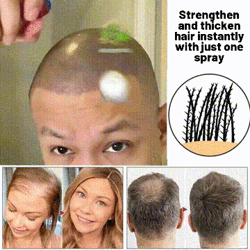 Spray naturale per la ricrescita dei capelli HZA™