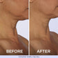 [GOPure official] Neck Cream Tighten & Lift Firming Cream for Crepey Skin Tightening Cosmetic - Clinically Proven, Safe & Clean, Dermatologist Recommended, Cruelty-Free