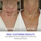 [GOPure official] Neck Cream Tighten & Lift Firming Cream for Crepey Skin Tightening Cosmetic - Clinically Proven, Safe & Clean, Dermatologist Recommended, Cruelty-Free