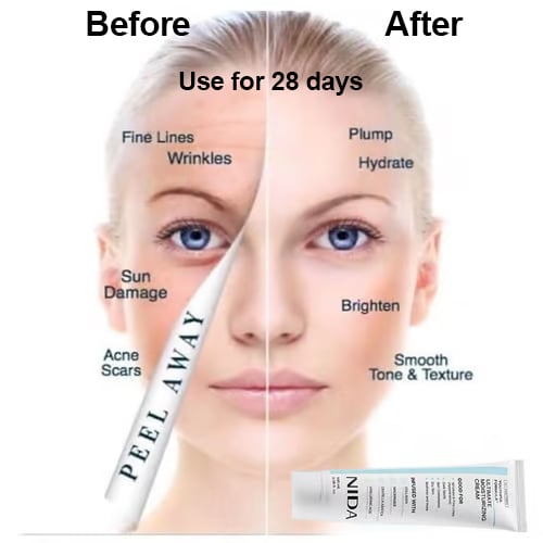 ✨ 2026 HOT SALE🎉💝NIDA Youthful Formula Ultimate Moisturizing Cream