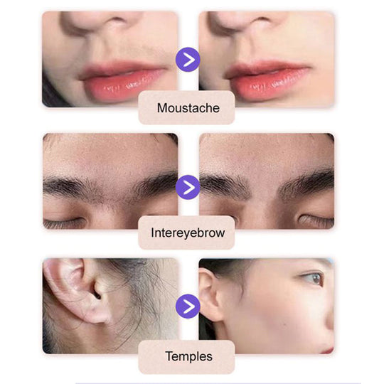 🔥Buy 2 Get 1 Free🔥Gentle and Painless Facial Hair Removal Cream | For Ultra-Sensitive Skin | Dermatologist Tested