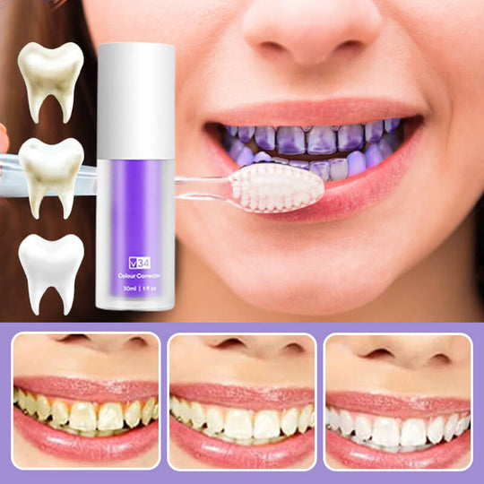 Réiteach bunúsach Ceartúcháin V34 Fiacla, Buí Spriocdhírithe Teicneolaíocht Ceartúcháin 7 Lá Whitening Taos fiacla Corcra Béil