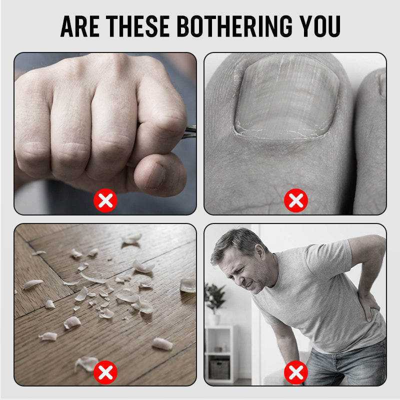 💥50% OFF⚡Splash-Proof Stainless Steel Nail Trimmer✨Sharp & Durable