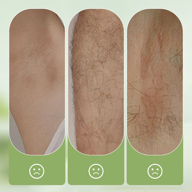 🎉This Week's Special Sales ✨Gentle and Non-Irritating Hair Removal Cream