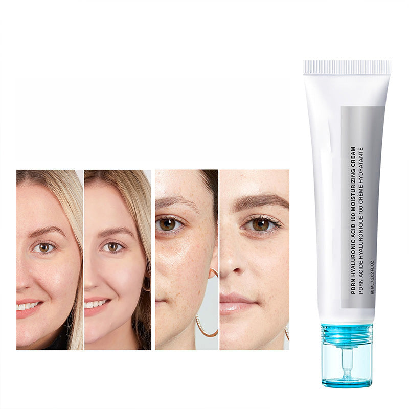 🥳2026 HOT SALE🥳PDRN Hyaluronic Acid 100 Moisturizing Cream