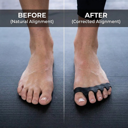 🏆2026 HOT SALE🥳💞50K+ SOLD!🎁Reusable & Washable Foot Alignment Correctors