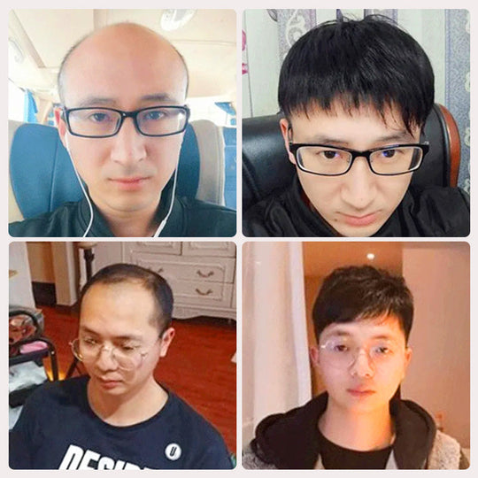 [Tankeväckande gåva] Mäns stretchnät peruker